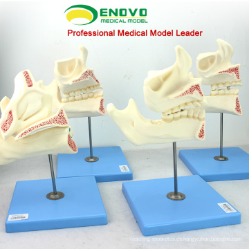 VENDER 12604 Modelo de desarrollo de demostración de dientes de niño a adulto